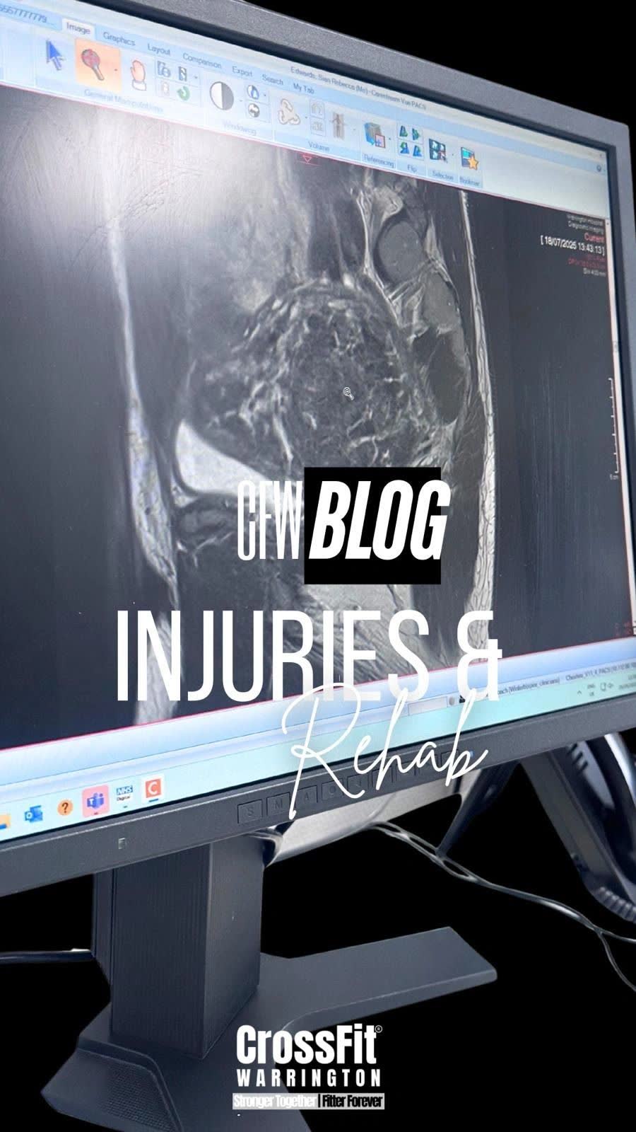 A computer screen showing a medical scan, with the words CFW Blog: Injuries & Rehab